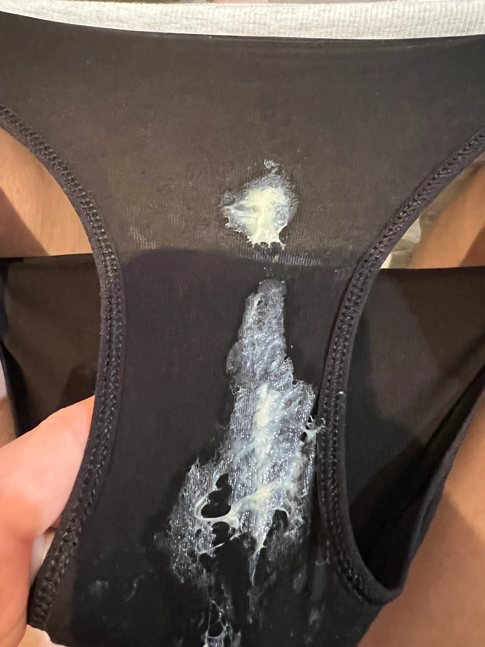 Clear, jelly-like mucus on dark underwear